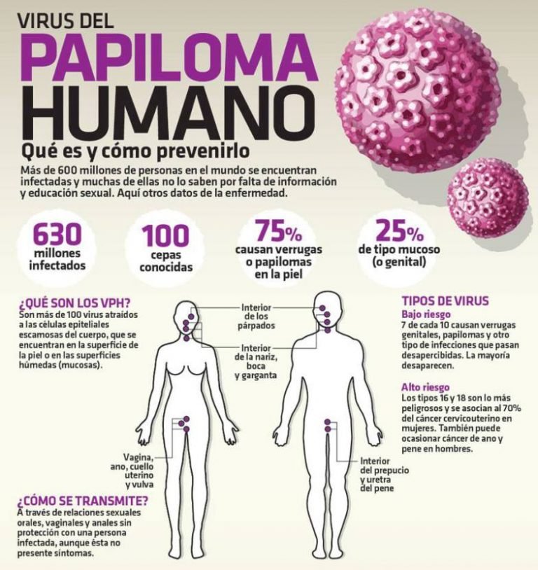 La Presencia De Vph Puede Provocar C Ncer C Rvico Uterino Esta